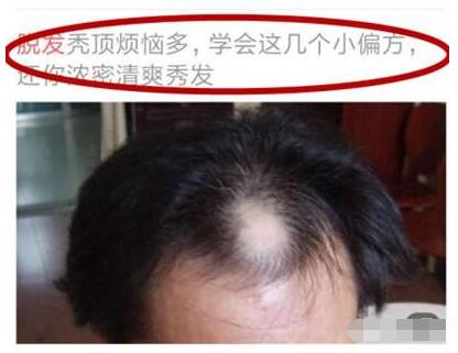 最新淘客赚钱方法,自媒体淘客小白入门