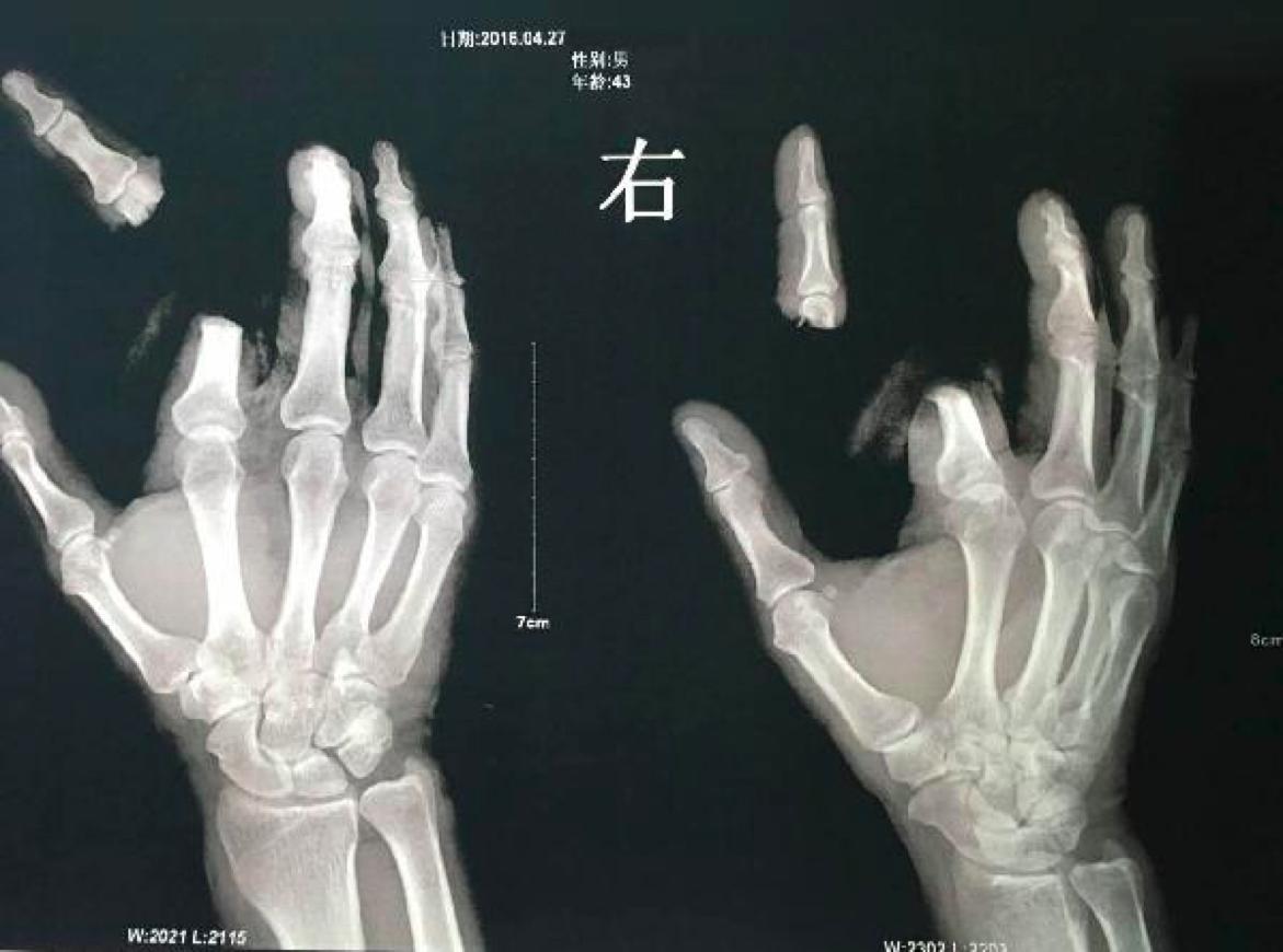 有剧毒,动物的毒性有多可怕