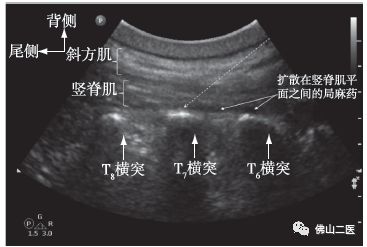 阿伯在医院苏醒视频,阿伯骨折