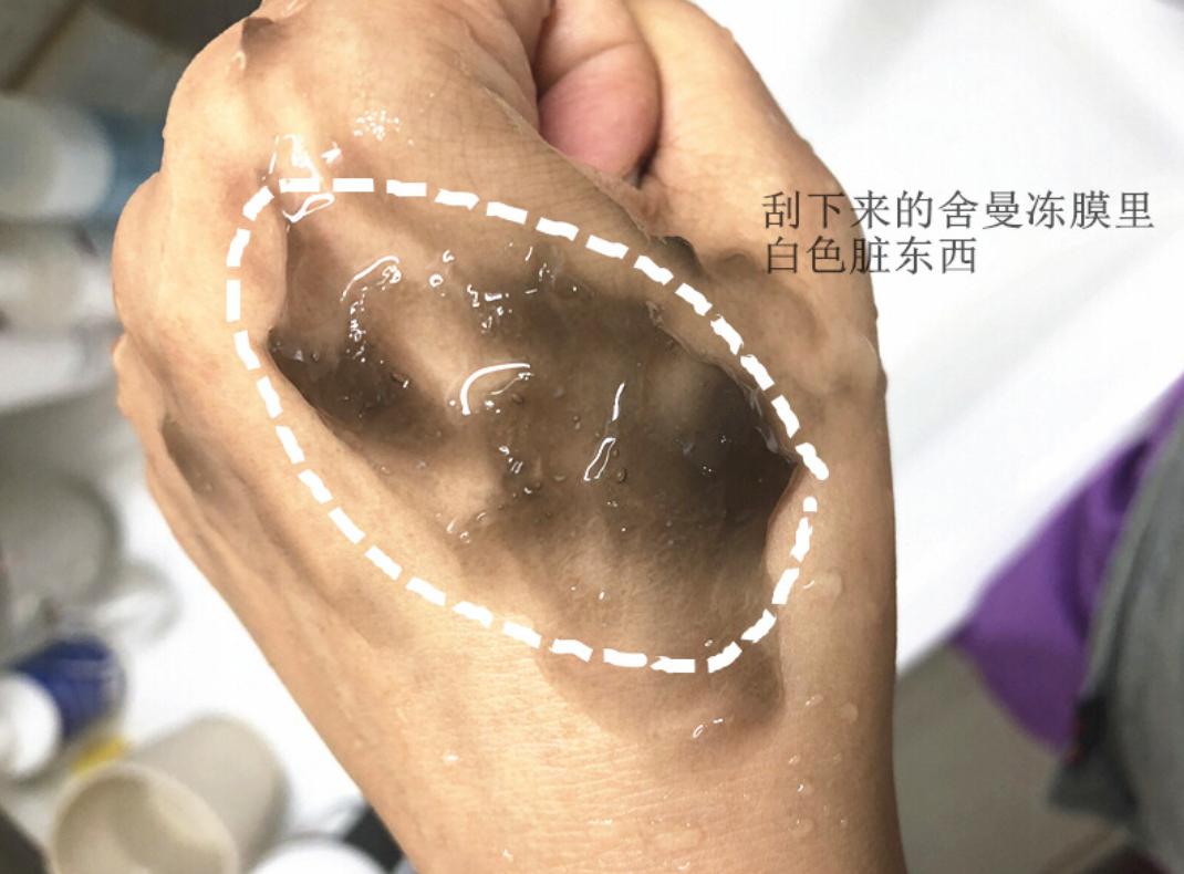 清洁冻膜真的是护肤必买产品吗？看看测评