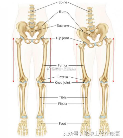 矫正长短腿去哪里矫正,体态矫正腿