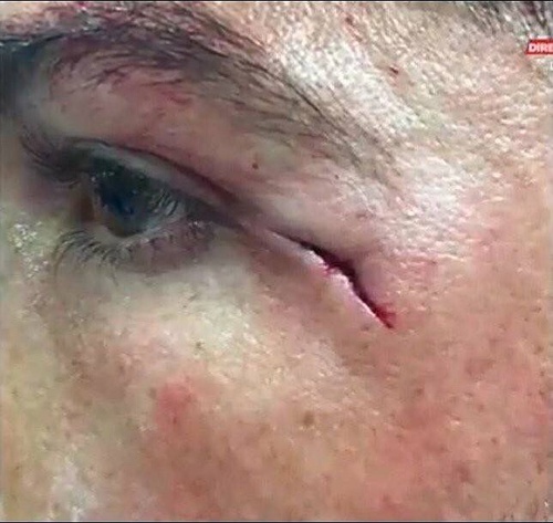 c罗受过最重的伤视频,c罗那些年欧冠