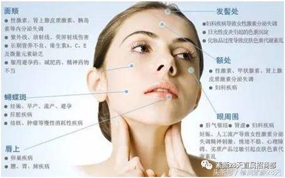修正妇科知识——从你的面色看妇科！肤色不好，全靠护肤品？