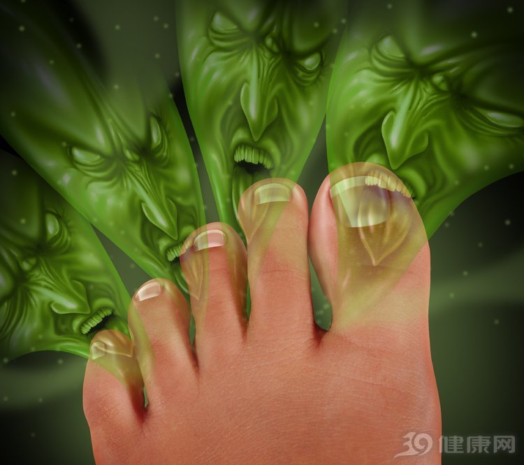 夏天脚臭太尴尬教你一招,夏季脚臭怎么办教你除臭方法