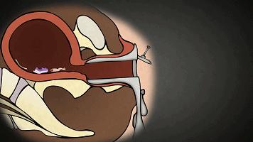 一组动图警示你,一组动图警示你绝望的操作