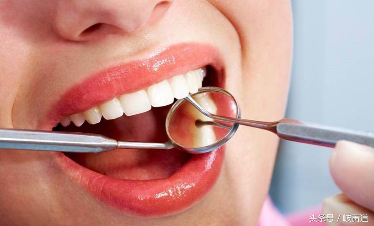 补完牙会更容易龋齿么,补完牙后更容易被龋坏吗