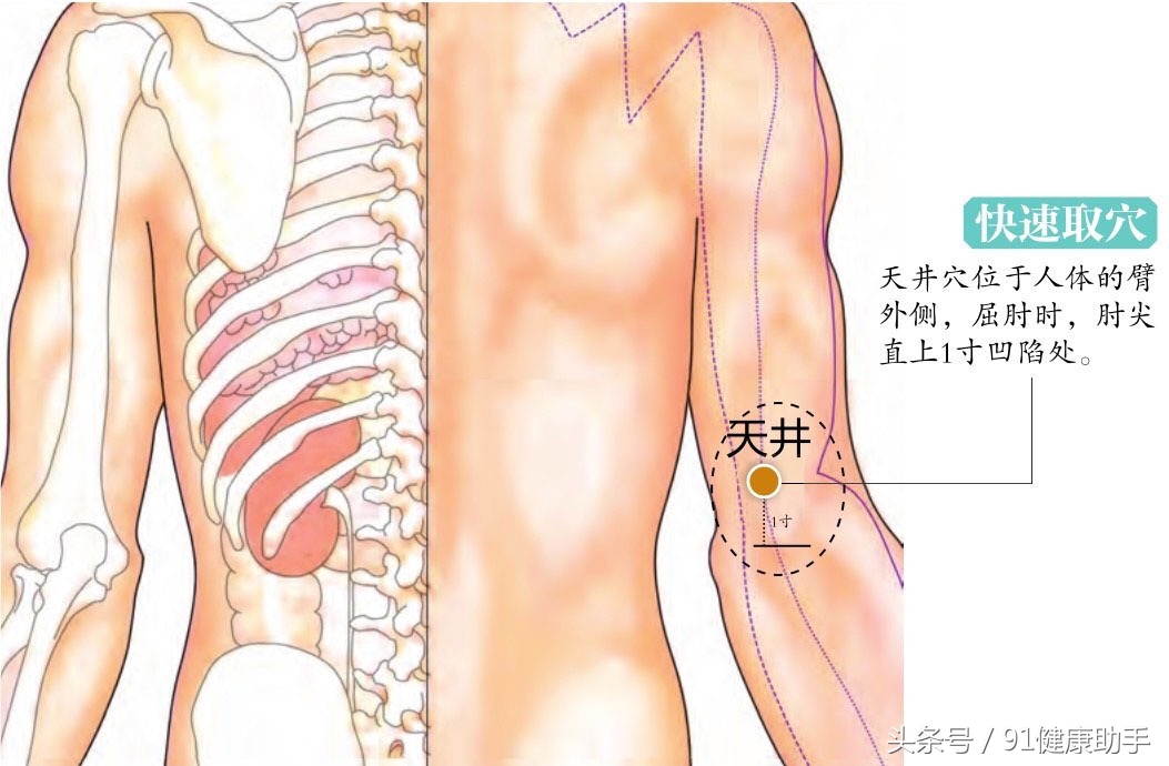 扁桃体炎中医穴位,风热荨麻疹针灸穴位