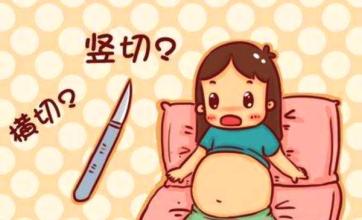 剖腹产手术选择,剖腹产切口怎么才算长好