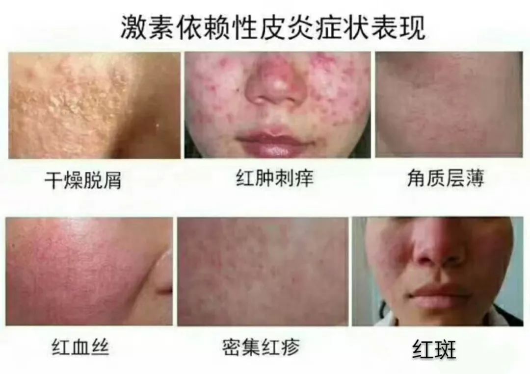 十大最坑爹护肤谣言视频,别再让这些谣言满天飞了