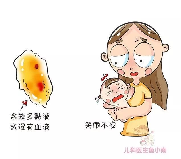 如何辨别婴儿大便性状,宝宝大便性状有哪些