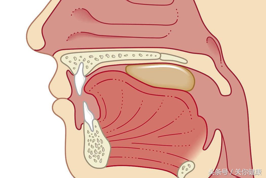 经常扁桃体发炎怎么保养,慢性扁桃体炎喉咙痒咳嗽反复发作