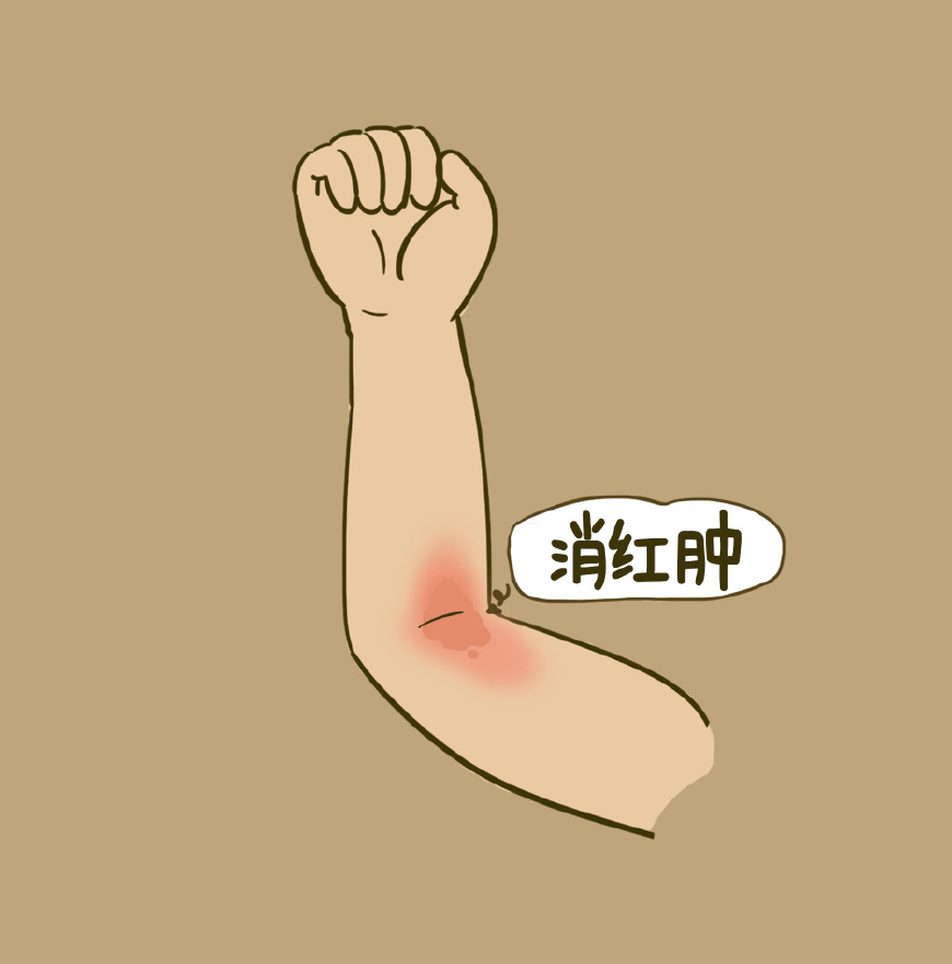 宝宝摔到后脑右侧,宝宝摔倒后后脑勺着地