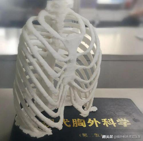 漏斗胸男怎么自己矫正,成年人漏斗胸保守治疗方法