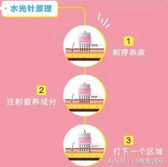 面膜vs精华,水光针和面膜哪个好