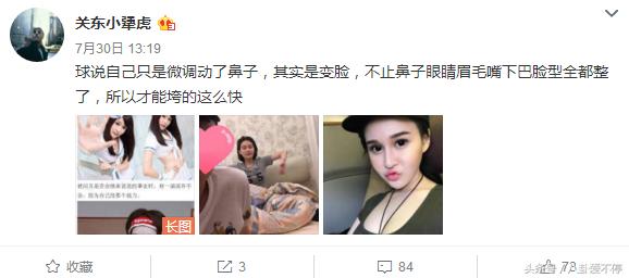 赵本山女儿球球整容的花费,爆料赵本山女儿球球