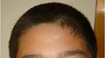 娃儿身上长“可可”该挂哪个科,妈老汉儿遇到这种情况最容易打蒙!