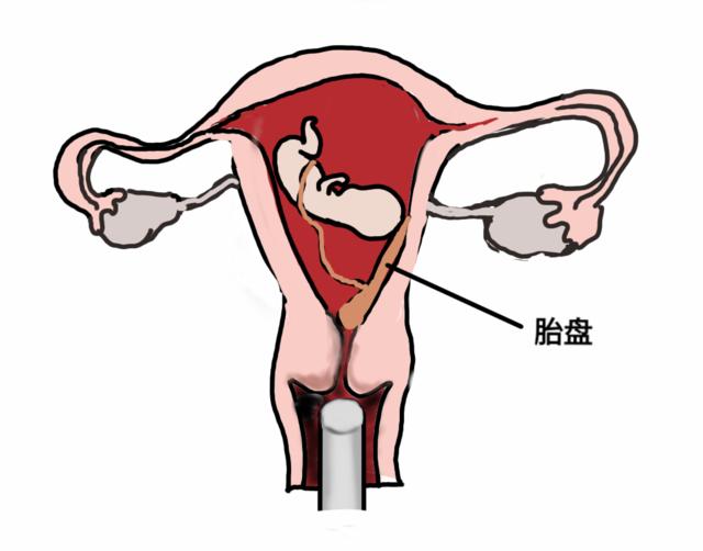 孕妈们为啥要做四维彩超,孕妇为什么要做泌尿系统彩超检查