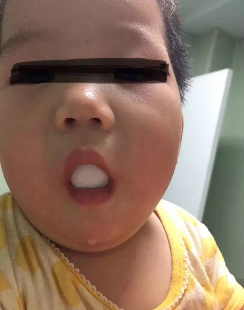 怎么检查宝宝鼻子塞入异物,如何预防孩子将异物塞入