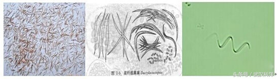 海边常见藻类植物图片,藻类植物常见的有什么