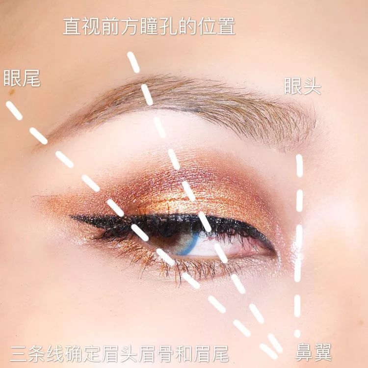 为什么三庭五眼眼距宽,眼距宽怎么改善做什么手术