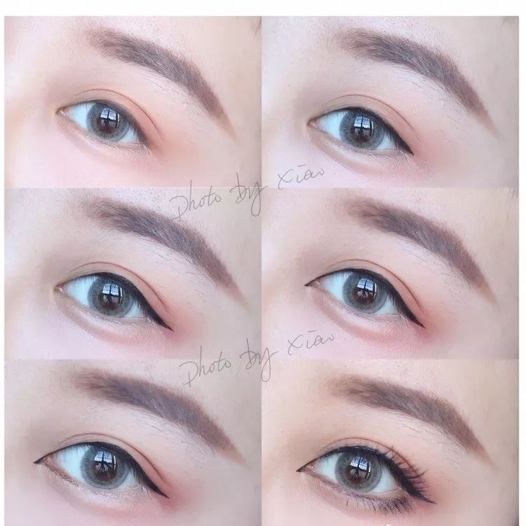 为什么三庭五眼眼距宽,眼距宽怎么改善做什么手术