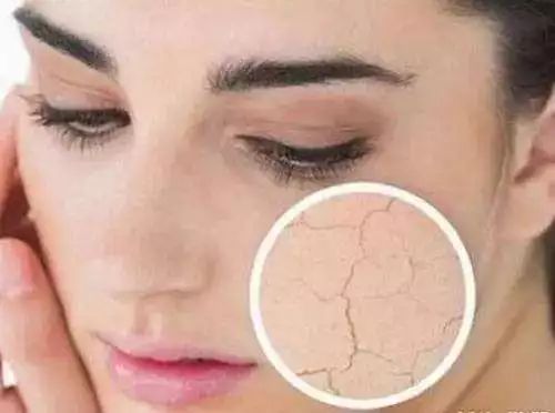 皮肤为什么锁不住水分,皮肤干锁不住水分用什么护肤品