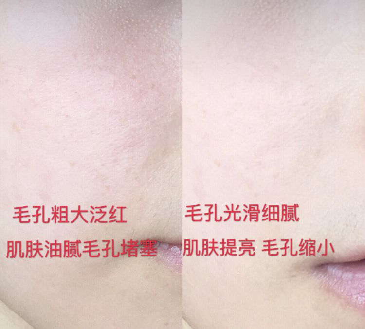 洁面仪luna同款,luna洁面仪平价替代