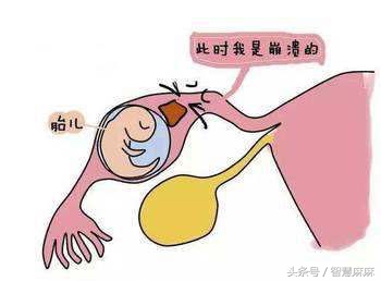 孕50天hcg只有14000,孕50天hcg1万没有胎心胎芽