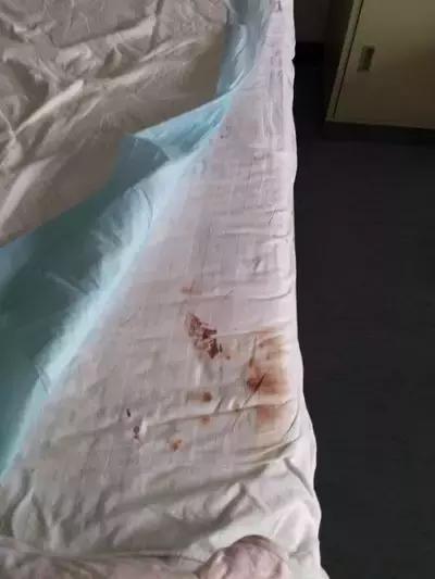 痒痒怎么办用什么药,痒痒怎么办小妙招