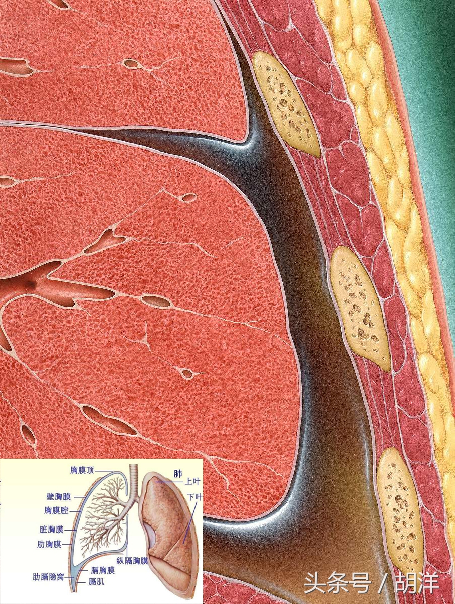 肺积水是怎么回事啊,肺积水由心脏原因造成的怎么办