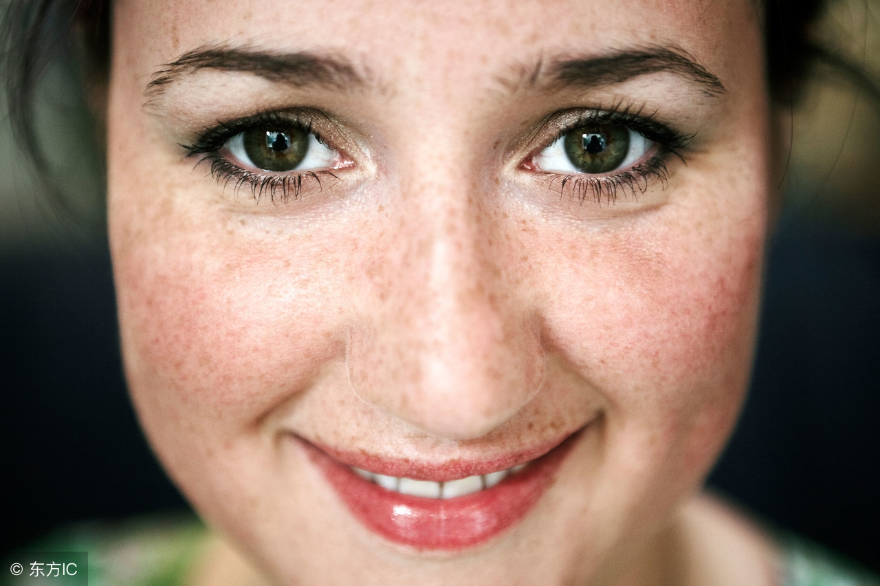 年轻人为什么长老年斑怎么预防,老年斑特别严重怎么办