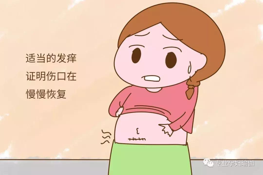 剖腹产有什么并发症吗,剖腹产后遗症要重视吗