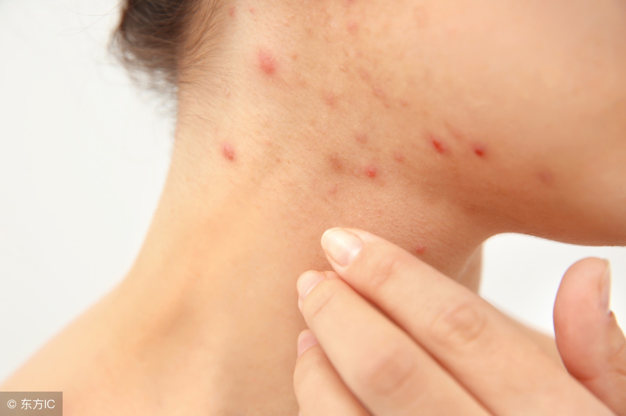 毛囊炎变成疮怎么办,毛囊炎是什么原因导致的