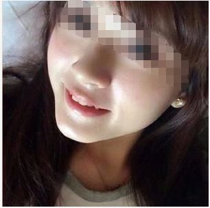 牙齿矫正8月最新价格,2024年30岁牙齿矫正费用多少钱