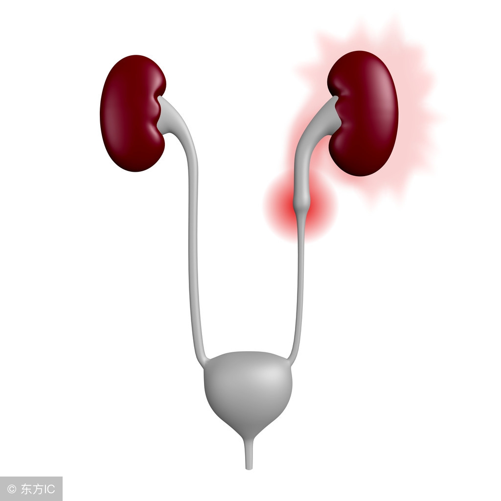 肾结石手术方法和注意事项,肾结石的手术方法最好的十种