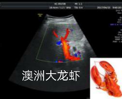 顺产的子宫为什么要流血,顺产后子宫有血怎么办