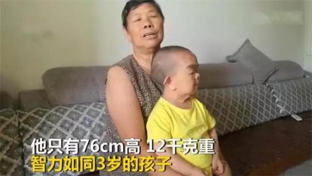 48岁儿子体重24斤，72岁老母亲：不敢死，怕没人照顾他