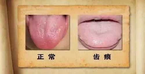 养胃养脾的健康小知识,健脾胃和调理脾胃的区别