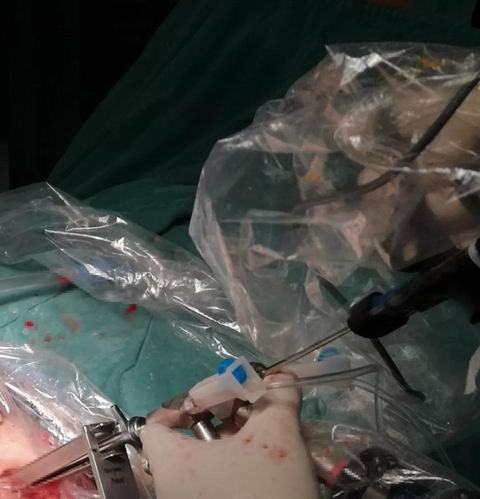 安阳市安钢总医院骨科专家,安钢医院脊柱微创中心主任名单