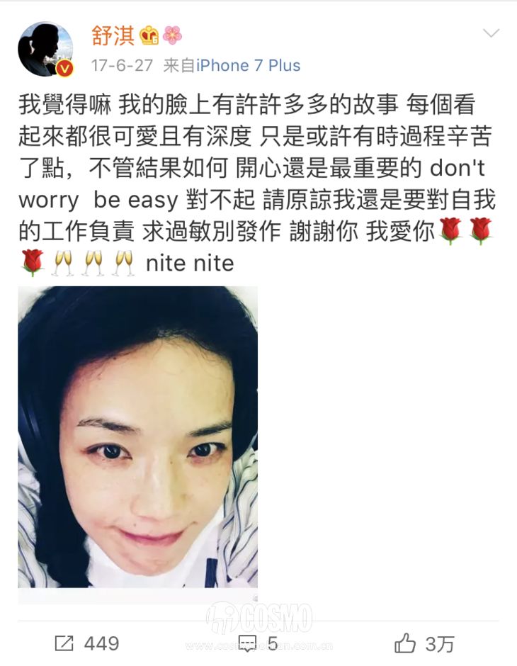 舒淇皮肤过敏,舒淇过敏脸是怎么好的