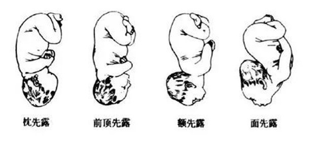 孕9个月胎儿姿势是什么样的,胎儿孕9个月在肚子里的姿势