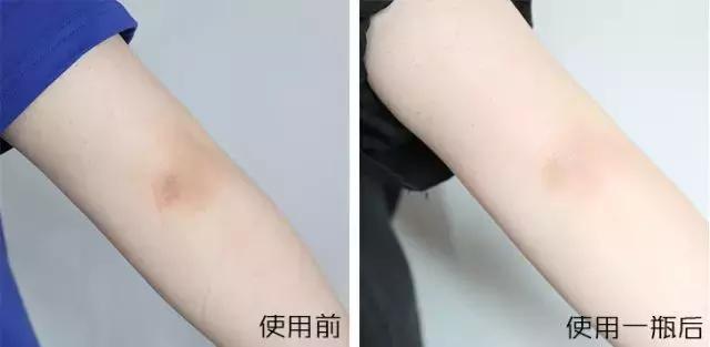 PP、腋下、手肘、三角区发黑暗沉？日本女*爱性**用好物推荐！