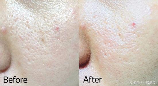 韩国黑泡泡面膜使用方法,韩国drjart绿面膜