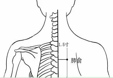 艾慈灸治疗咳嗽,怎么温灸治疗咳嗽
