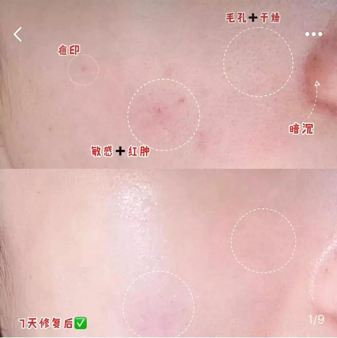 补水涂抹式面膜复活草,ph复活草涂抹面膜