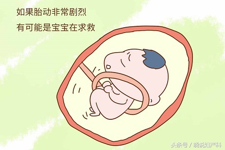 医生，请告诉我胎动的那点事吧！