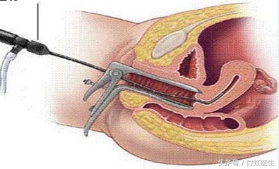 大姨妈有血块什么情况,大姨妈有血块是什么原因
