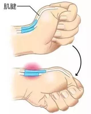 生完娃如何缓解全身疼痛,生完孩子感觉浑身没有力气