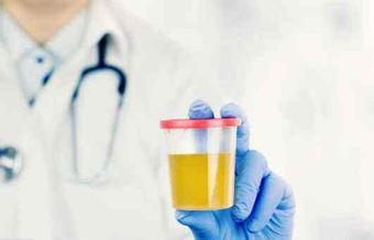 尿液特别不好闻,尿液异常腥臊难闻吃什么药