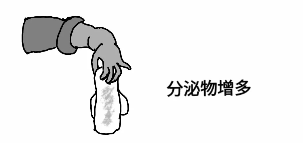 女性宫颈糜烂是什么原因引起的,女性宫颈糜烂有什么症状和现象